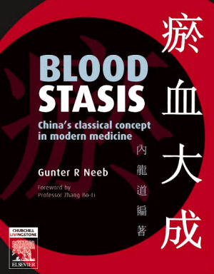 Blood Stasis China's classical concept in modern medicine