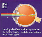 Healing Eyes with Acupuncture DVD