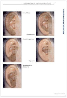 Microsystems Acupuncture