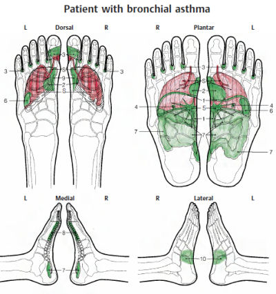 Reflexotherapy of the Feet