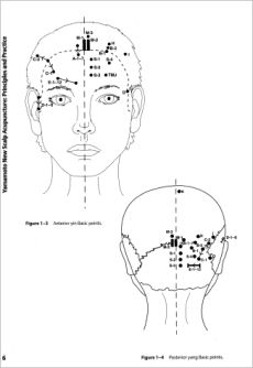 Yamamoto New Scalp Acupuncture