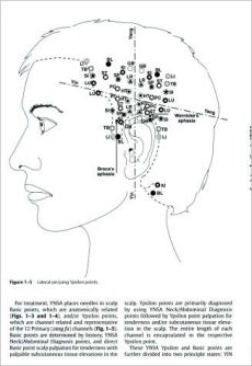 Yamamoto New Scalp Acupuncture