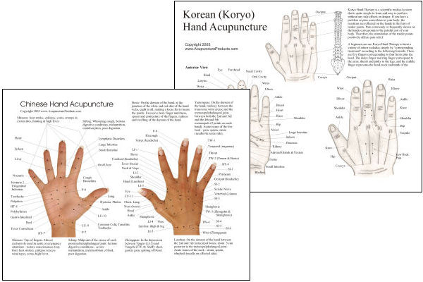Chinese Hand Acupuncture Chart