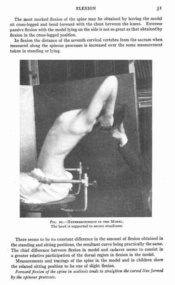 Lateral Curvature of The Spine and Round Shoulders