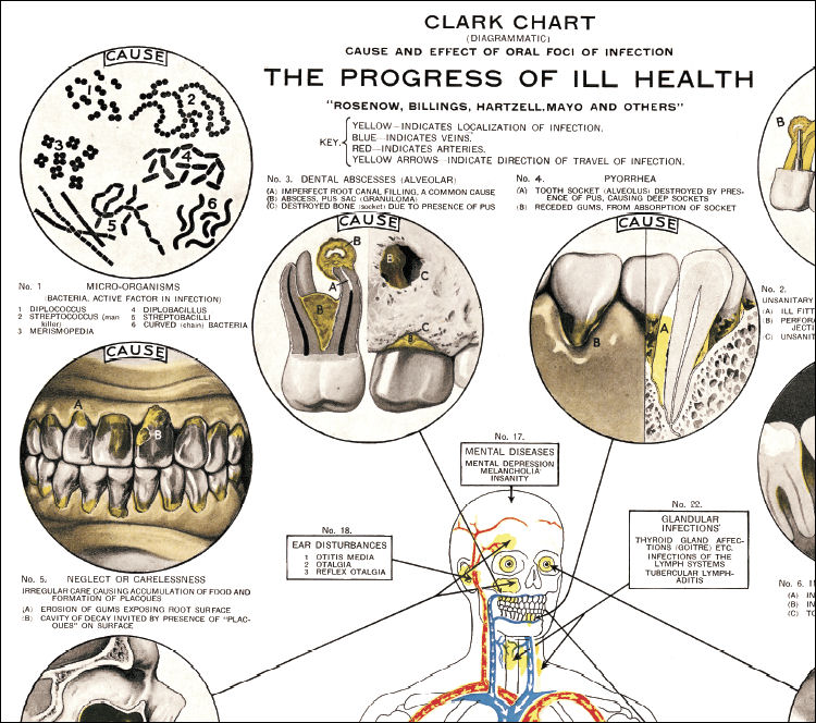 Clark Dental Health Chart2