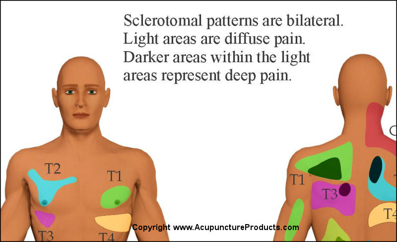 Sclerotomal Pain Referral Patterns
