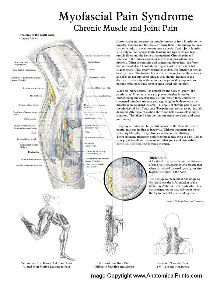 Myofascial Pain And Dysfunction The Trigger Point Manual Free Download