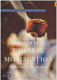 Illustrated Chinese Moxibustion Techniques and Methods