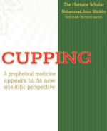 Cupping: A prophetical medicine appears in its new scientific perspective