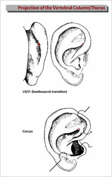 Ear Acupuncture