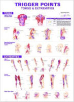 Trigger Point Wall Charts