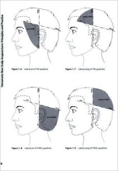 Yamamoto New Scalp Acupuncture