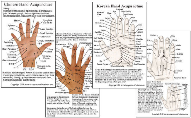 Acupuncture Hand Chart