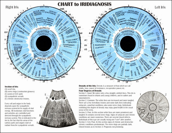 Iridiagnosis Iridology Chart