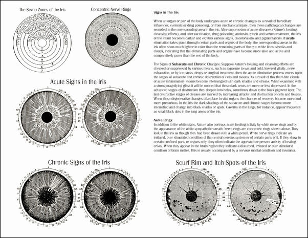 Iridiagnosis Iridology Chart