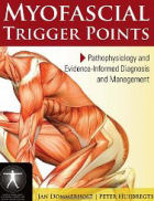 Myofascial Trigger Points