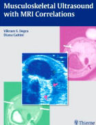 Musculoskeletal Ultrasound with MRI Correlations