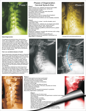 Cervical Spinal Degeneration Pad
