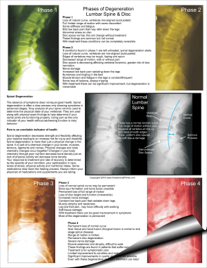 Lumbar Spinal Degeneration Pad