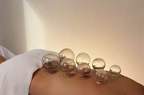 Cupping