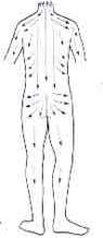 Gua Sha Back
