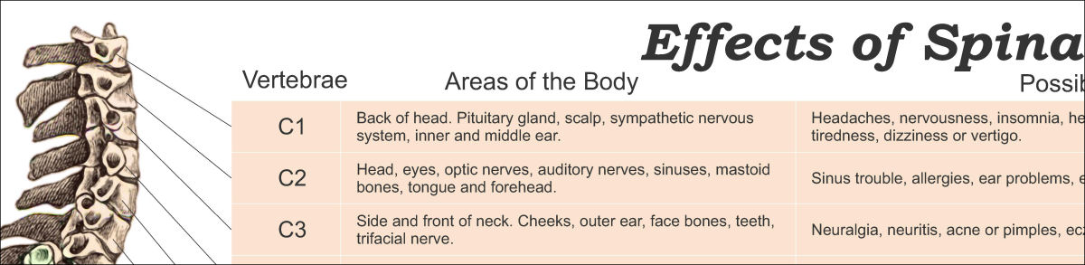 Effects of Spinal Subluxation Chart