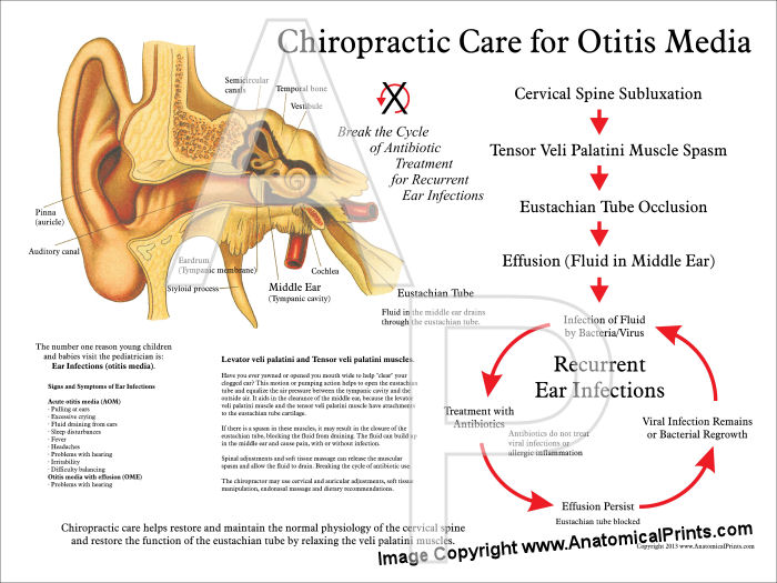 Chiropractic Treatment Of Ear Infections Poster