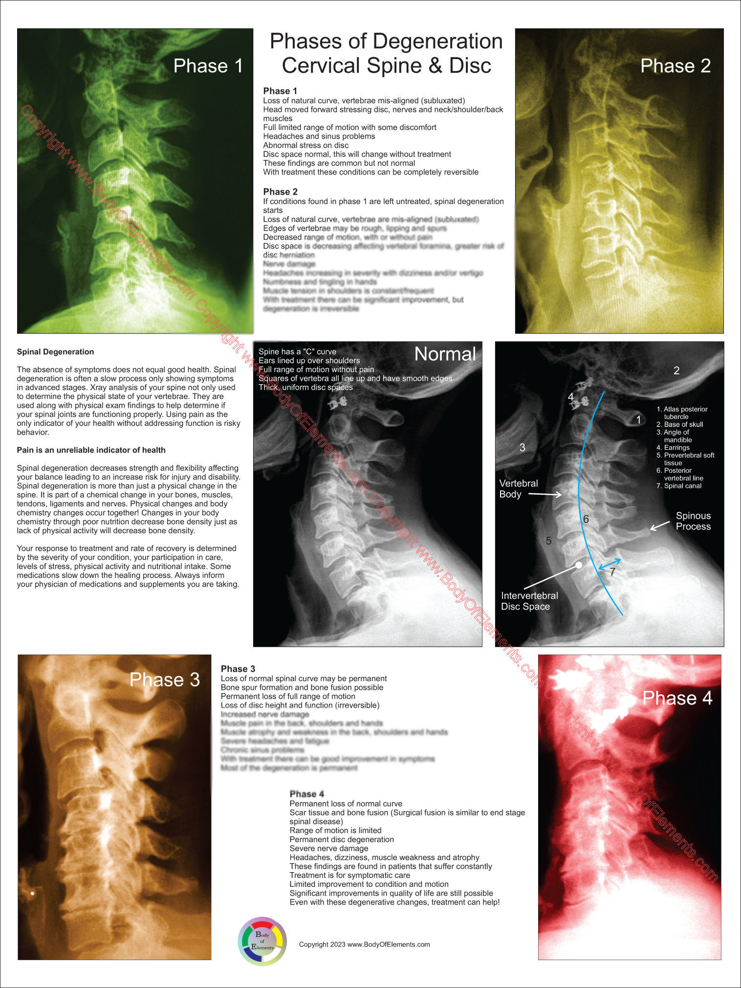 Chiropractic Posters And Charts