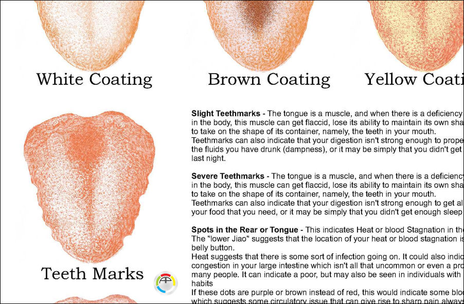 Chinese Medicine Tongue Chart