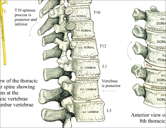 Chiropractic Subluxation Complex Poster